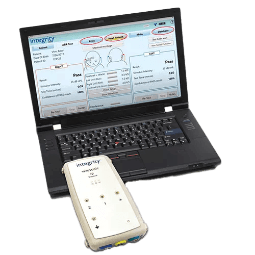 xvivosonicv500newbornscreenermain.jpg,qh=500,ala=en,aw=500,arev=0DE5,ahash=2E7F9F6FBD17E4B38C7918B49E65B43C.pagespeed.ic.VVXYFidL2C.png